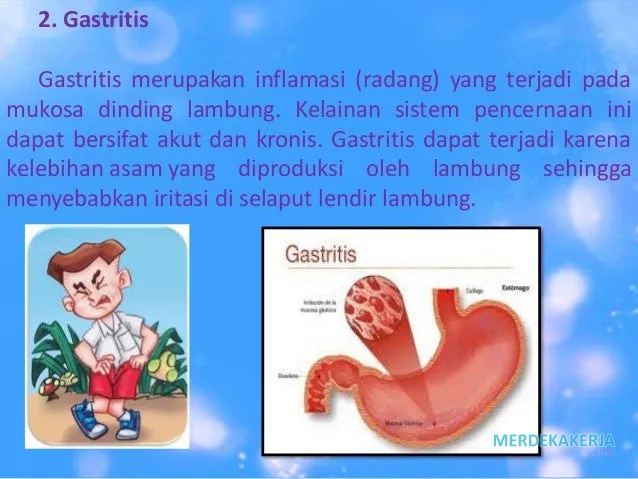 Gangguan pada sistem organ manusia